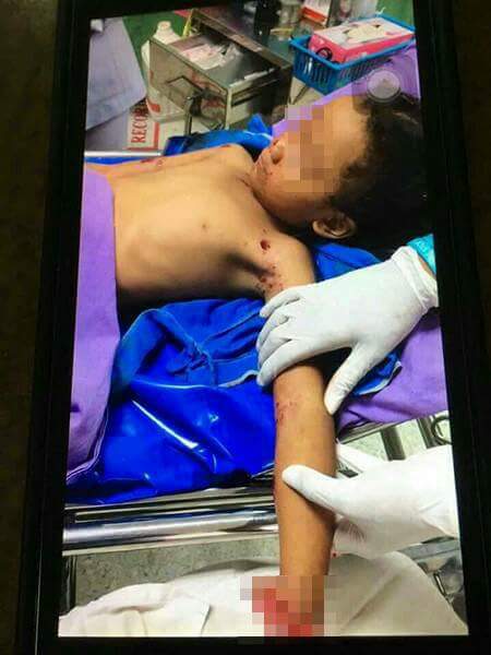 FB_IMG_1497587454485