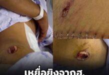 ซอและ’ เหยื่อถูกยิงจากฮ.เข้าแจ้งความ สภ.จะแนะ ท้าพิสูจน์ความจริง